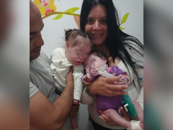 Tiene 19 meses, está separada de su gemela y necesita enfermeros para volver a su casa en La Plata: "Quiero estar con ella"