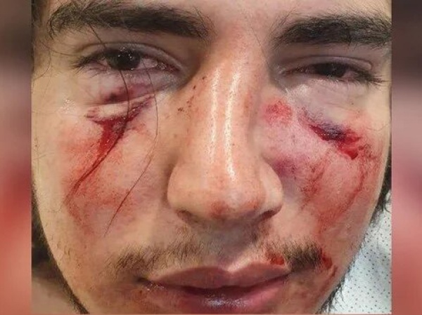 Sucedió en Córdoba: cuatro rugbiers golpearon brutalmente a un joven en su fiesta de egresados