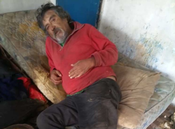 Calamitosa situación de un platense: esperó 3 horas en el Hospital San Roque y tiene el pie gravemente infectado