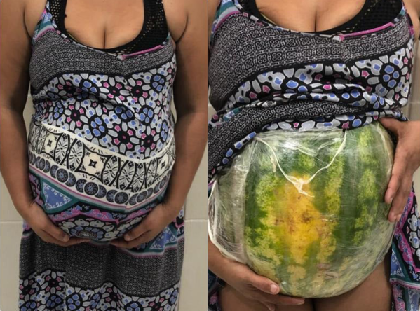 Simuló un embarazo con una sandía para transportar cocaína en Brasil