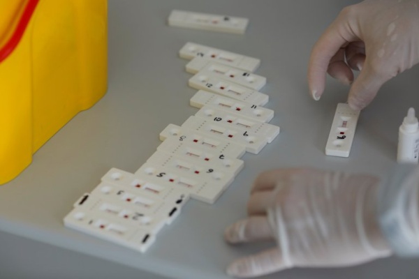 Aprobaron el primer sistema de prueba de anticuerpos de uso hogareño