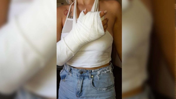 Una platense denunció que su ex pareja la golpeó, ahorcó y le robó: “Me quebró la muñeca y amenazó con pegarle a mi hija"