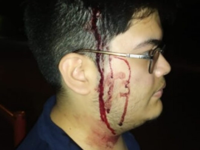 Un estudiante de la Facultad de Informática fue salvajemente golpeado por delincuentes dentro del predio