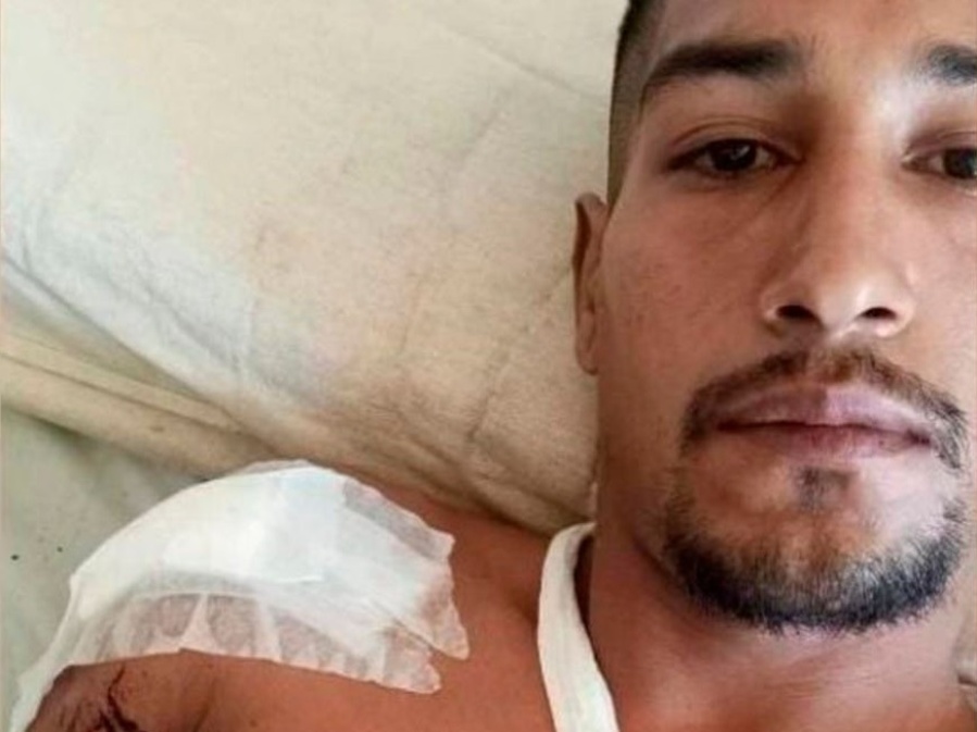 Balearon a un jugador de fútbol en Los Hornos y fue derivado de urgencia al Hospital San Martín