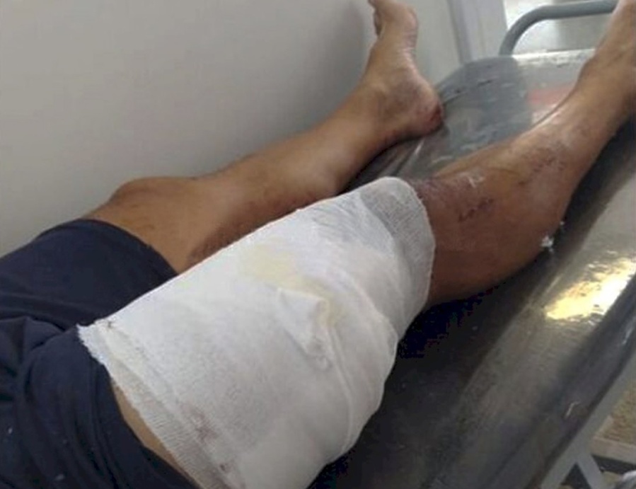 Fue apuñalado durante un robo en Altos de San Lorenzo y ahora no puede caminar: su familia pidió ayuda a la comunidad