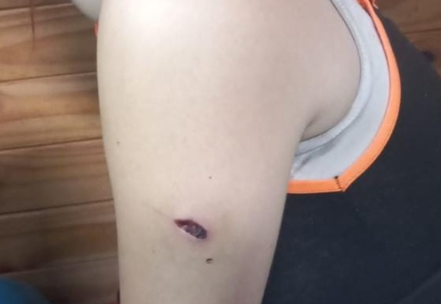 Una mujer apuñaló a otra en La Plata e intentó herir a la policía