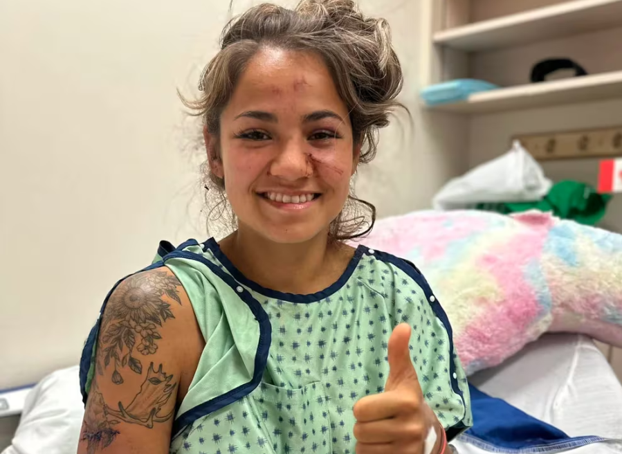 Paseaba con su perro por un bosque, luchó contra 4 osos y sobrevivió gracias al broche de su pelo