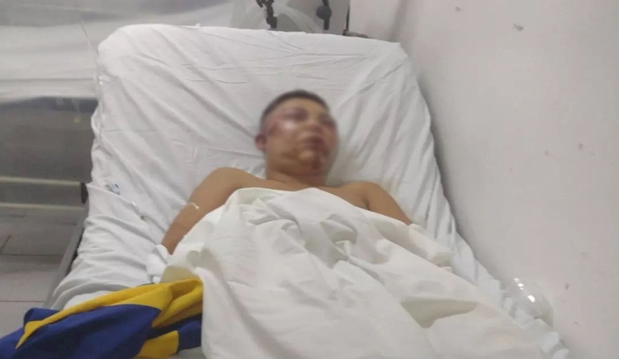Un joven que hizo inferiores en Estudiantes fue desfigurado a la salida de un boliche y lo siguen amenazando