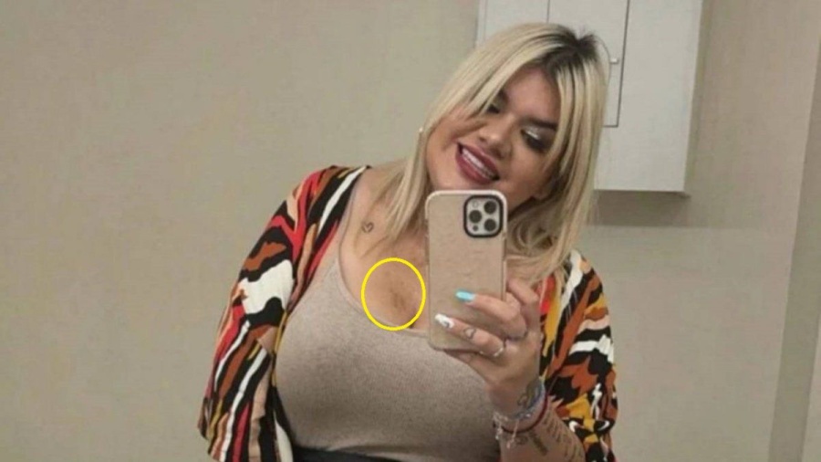 Morena Rial: ”Me hice la panza, la cola, los brazos...”