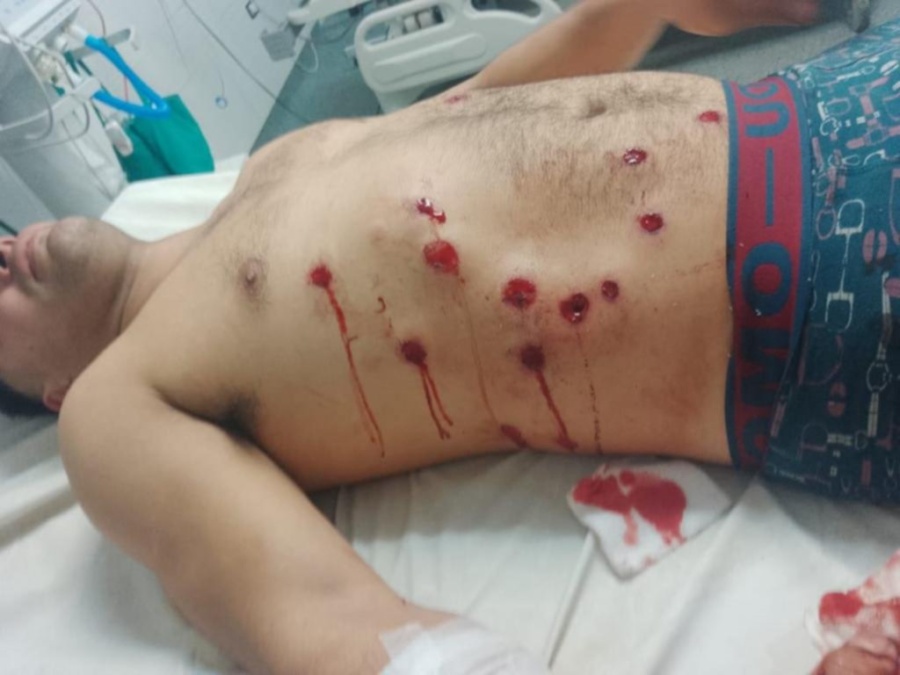 Balas de goma, corridas y heridos en un partido de la Liga Amateur Platense