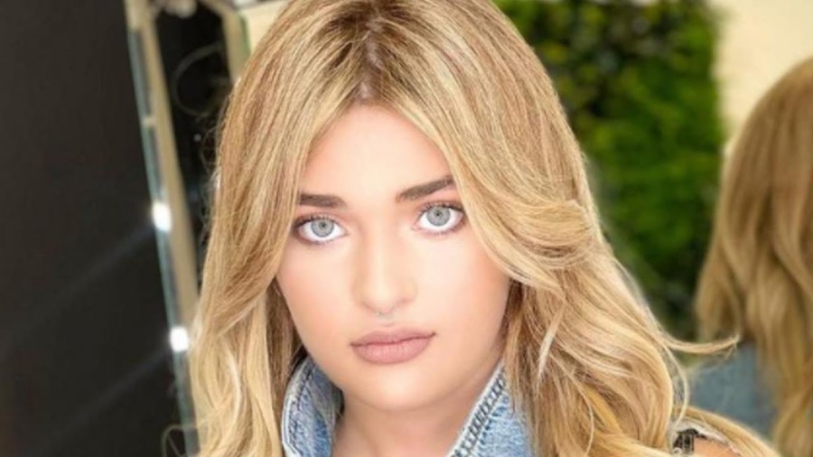 La confesión de Martita Fort: ”Me inyectaron ácido hialurónico”