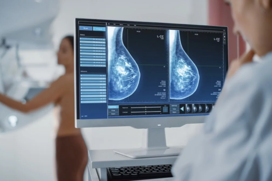 Lanzan una maratón de mamografías gratuitas en el Hospital Rossi de La Plata para este fin de semana