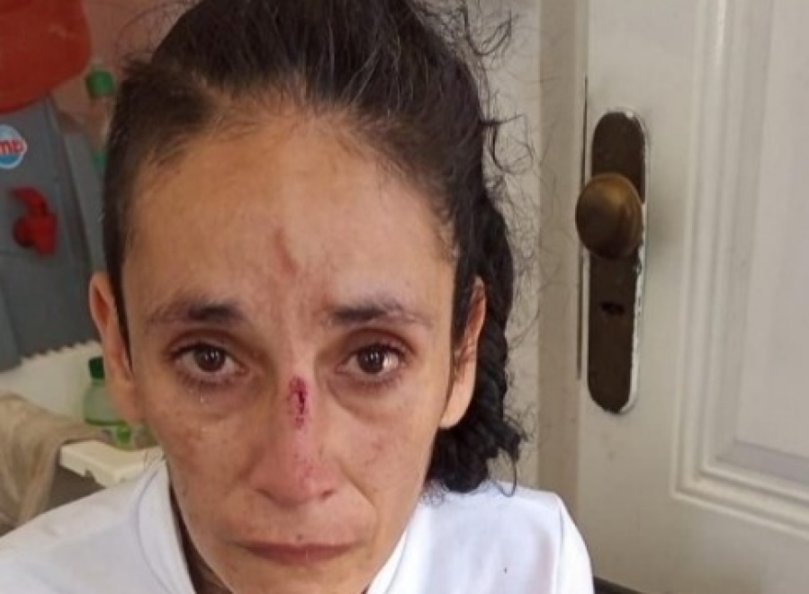 Piedrazos en la Autopista Buenos Aires - La Plata: una militante fue herida cuando se dirigían al acto de Cristina
