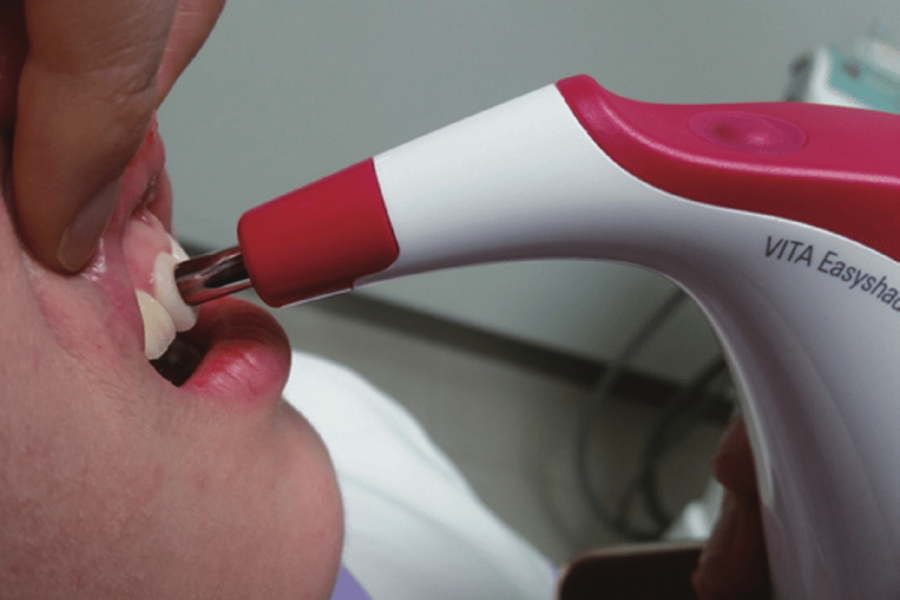 La Facultad de Odontología de La Plata incorporó diez espectofotómetros digitales de última generación: ¿Para qué sirven?