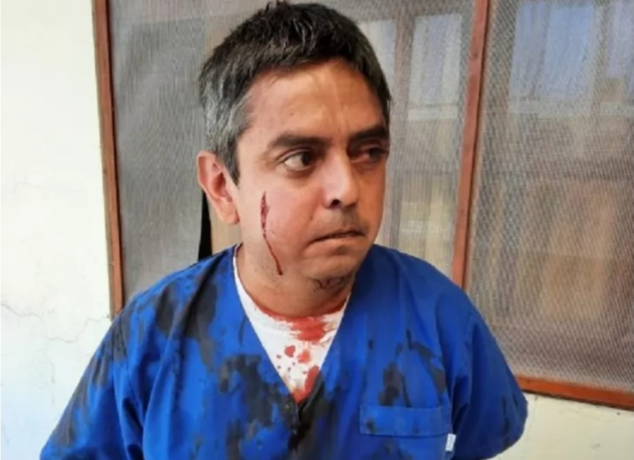 Es secretario de Salud y recibió una golpiza por parte de un hombre que lo increpó por contagiarse de COVID-19