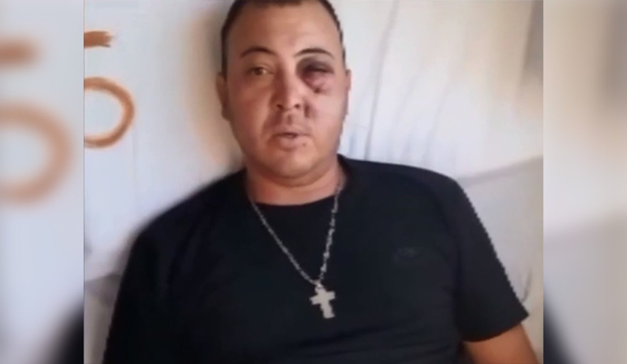 Piden donaciones para cubrir los gastos del hincha tripero que perdió el ojo: ”Me pusieron ocho placas en la cara”