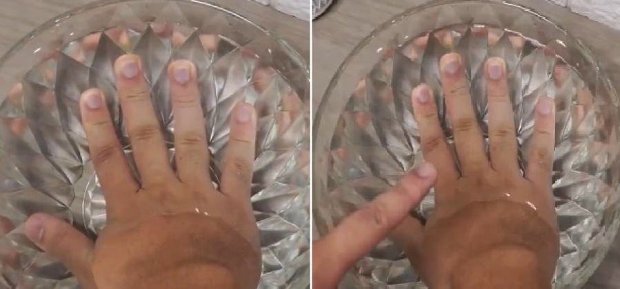 ¿Te duele la cabeza? Un particular método chino que promete aliviar esa molestia apareció en las redes y se hizo viral