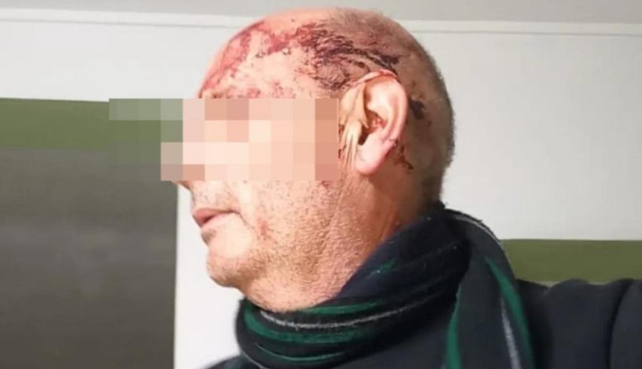 Delincuentes sorprendieron a una pareja de 60 años en La Plata