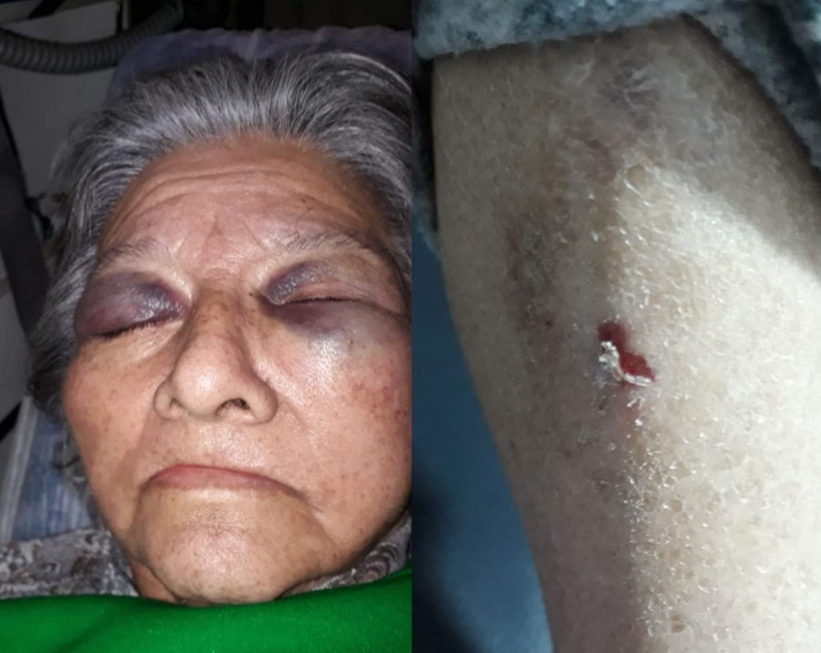 Denunciaron penalmente al geriátrico platense Santa Teresita de Ávila: una abuela fue hallada en el piso y con graves heridas
