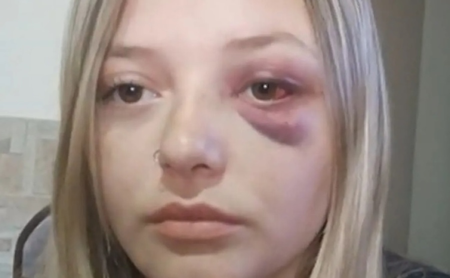 Quiso defender a su amiga que estaba siendo ahorcada y recibió una trompada