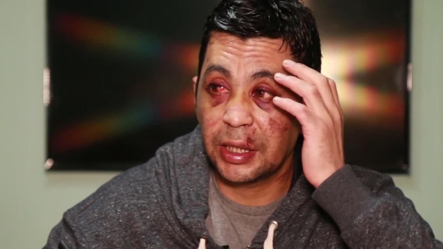 Tuvo COVID-19, lo lincharon, le incendiaron la casa y un año después murió de tristeza