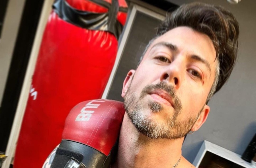 Es de Tolosa, los lunares le daban vergüenza y ahora “cautiva” al público femenino: “Me dicen que parece un tatuaje”