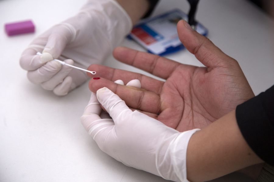 Especialistas advierten que el 30% de los diagnósticos de VIH-Sida todavía se hacen en forma tardía