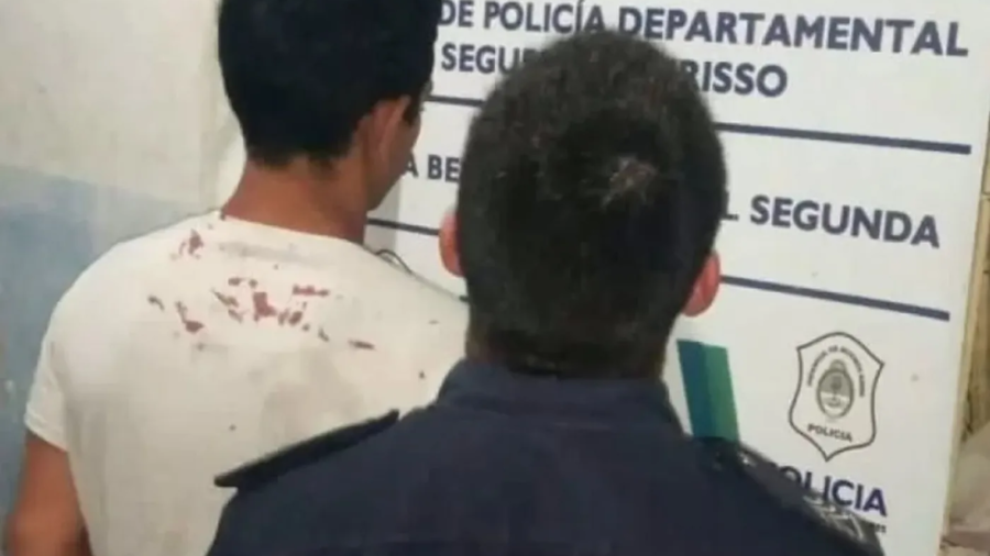 Detuvieron a un hombre en Berisso por quemar con leche hirviendo a sus propias hijas: investigan también a la madre