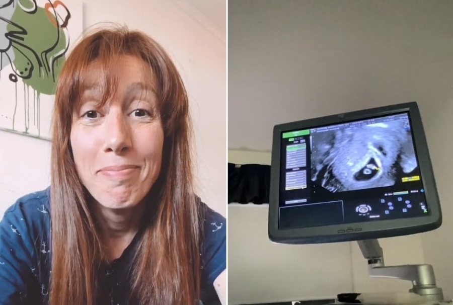”Todo era risas hasta que...”: se fue a hacer una ecografía de embarazo y una imagen en la pantalla lo cambió todo