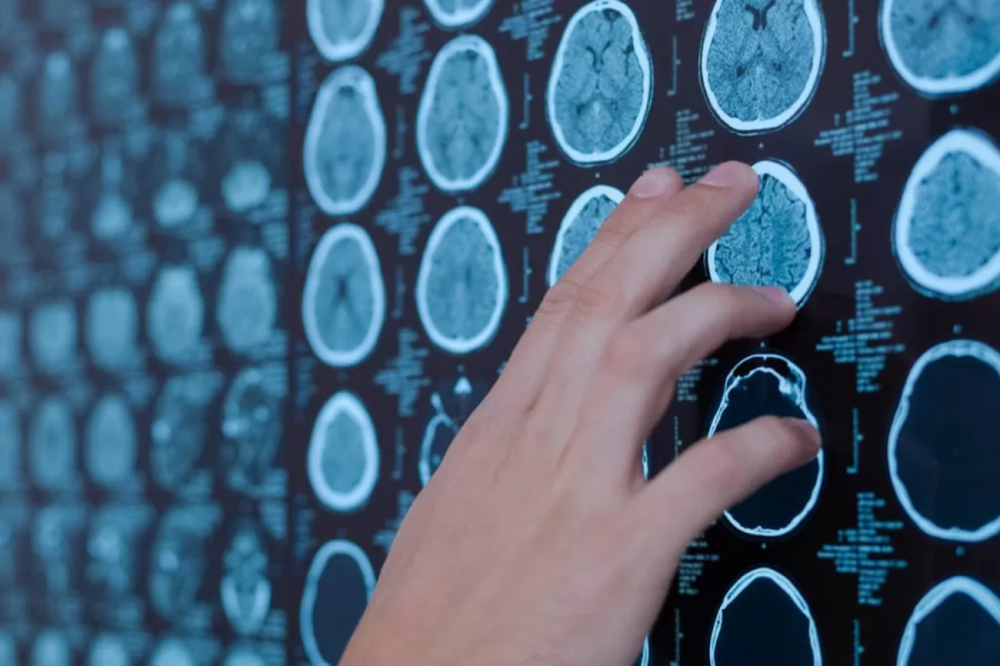 Científicos argentinos lanzaron un asistente virtual en WhatsApp para reconocer síntomas de ACV