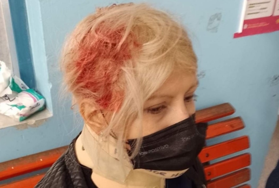 A una docente de Villa Elisa se le desplomó una ventana encima en plena clase y se salvó de milagro: “Nos preocupamos mucho”