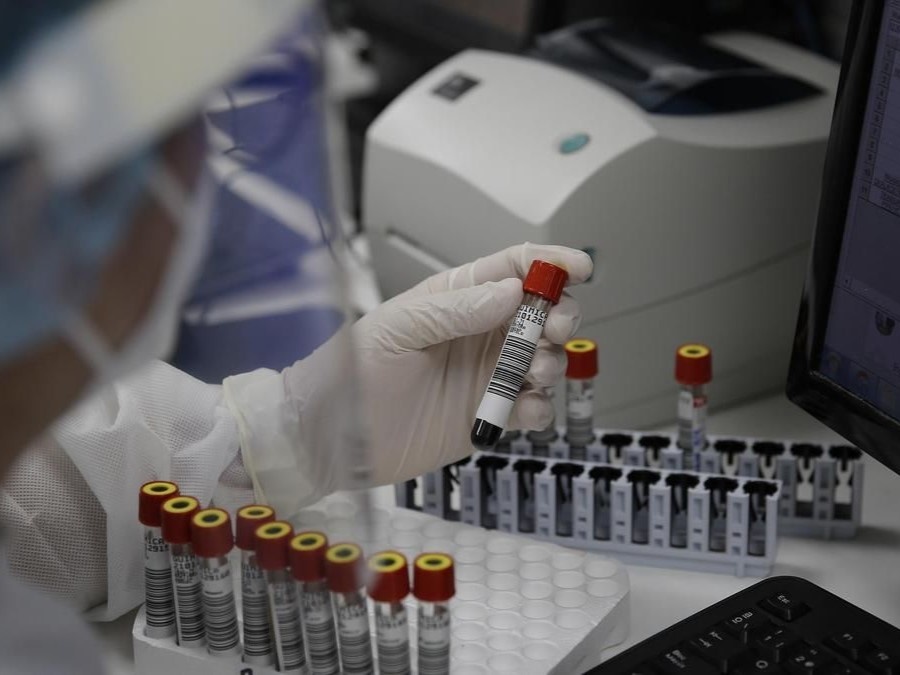 Confirman un caso de viruela del mono en La Plata: Se trata de un hombre de 49 años