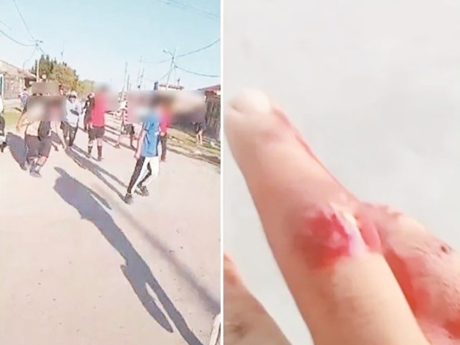 Violento enfrentamiento en un partido de la Liga Amistad entre equipos de Berisso y Ensenada