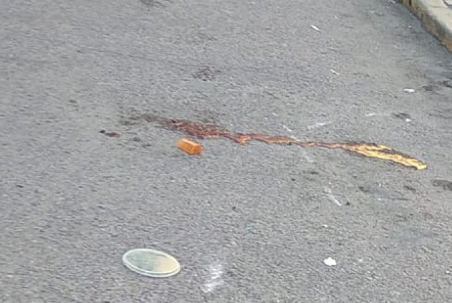 Perdió el control de su moto y se estrelló la cara contra el asfalto en pleno centro platense