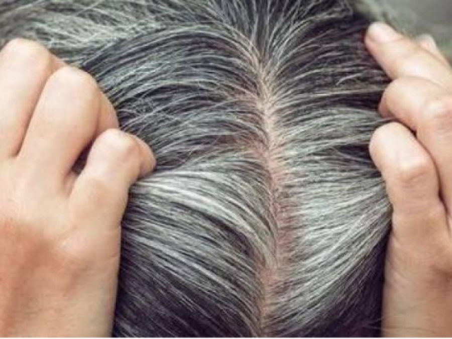 Especialistas revelaron que las canas pueden prevenirse con hábitos saludables