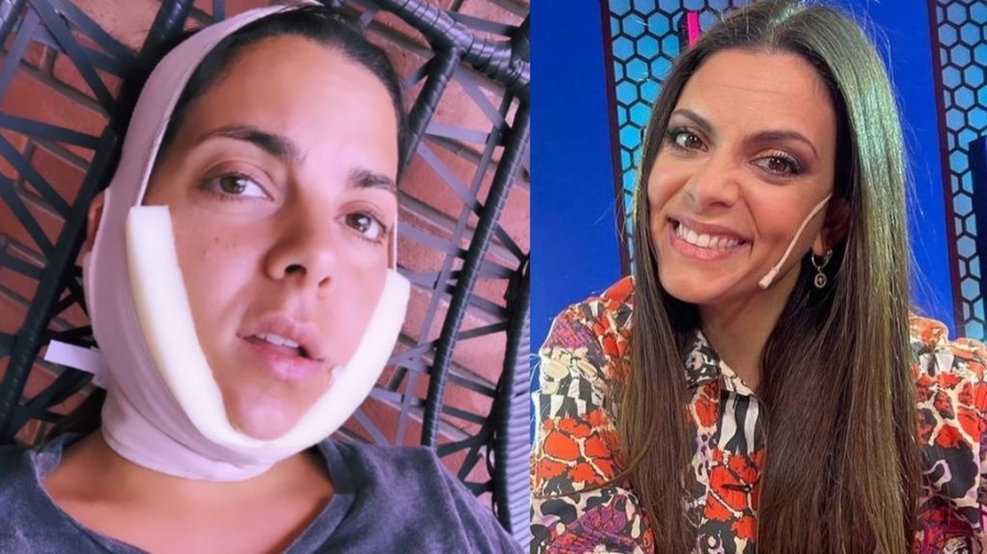 Belu Lucius compartió la peculiar y tremenda operación estética a la que se sometió: ”Hace años que venía...”