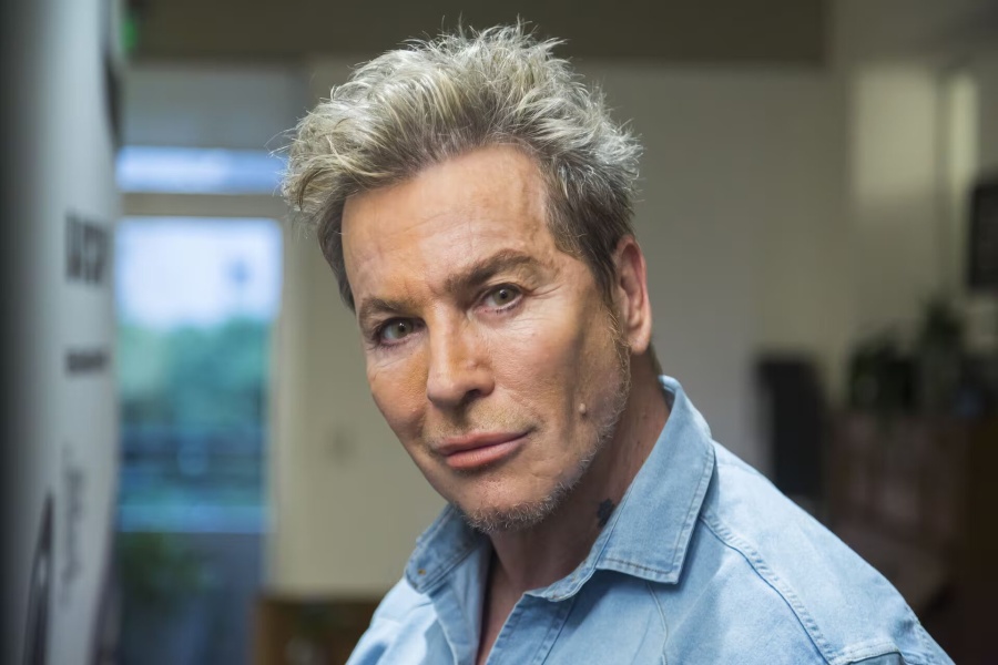 Guido Süller mostró el antes y después de sus retoques estéticos y reveló su mejor secreto para mantenerse joven