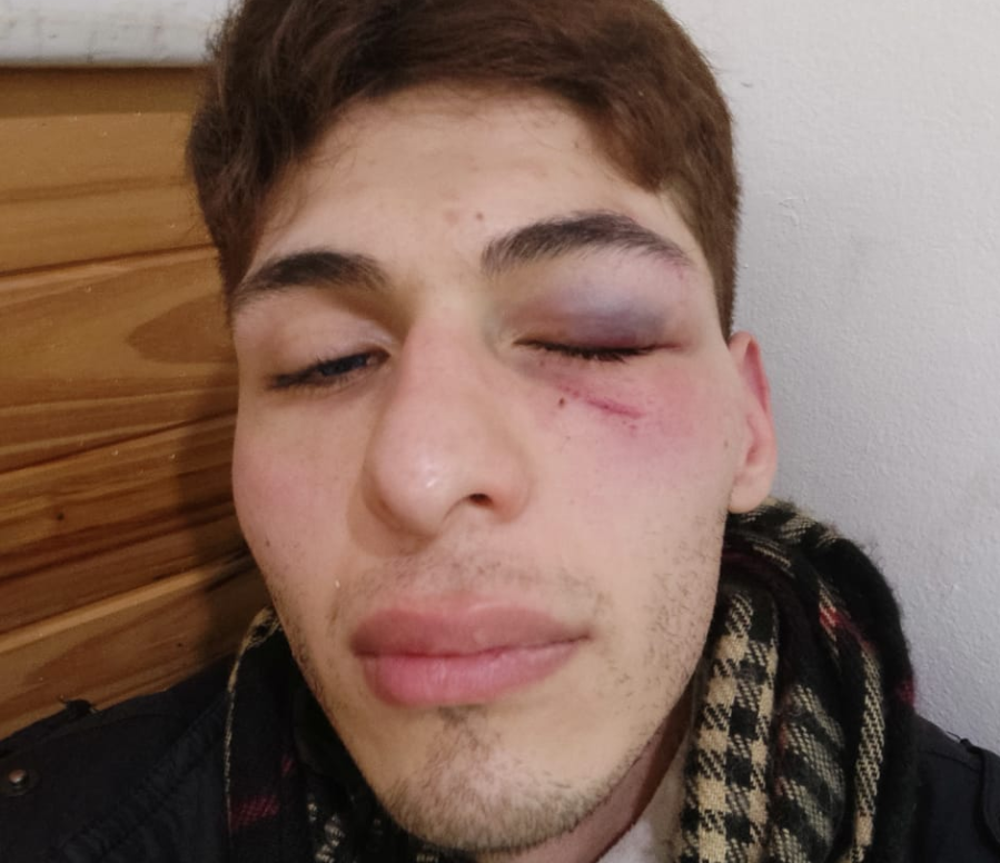 Lo destrozaron a golpes por ser gay y sufrir autismo en La Plata: ”Sabían que tenía una discapacidad”