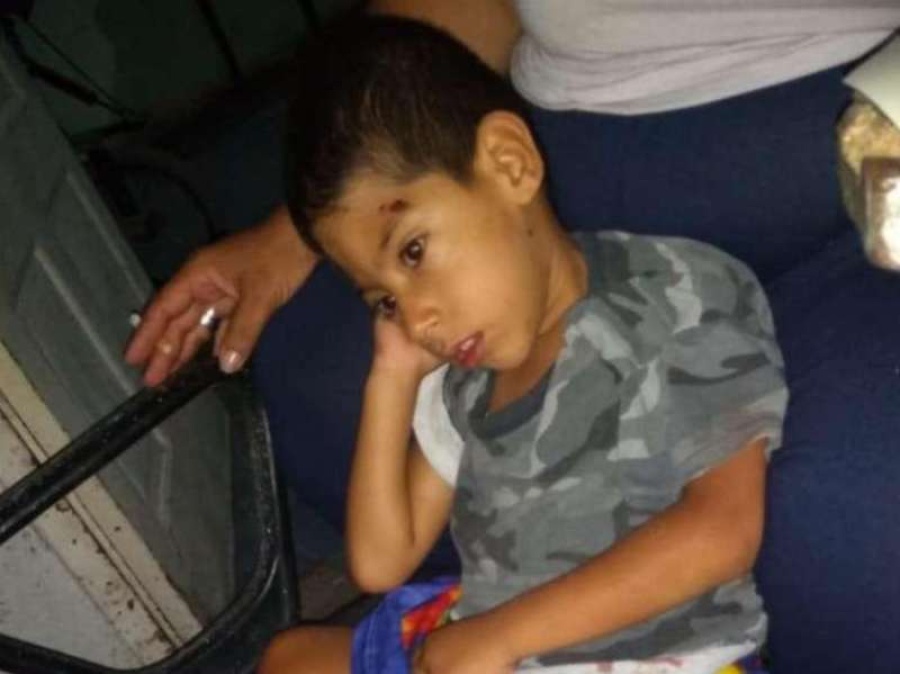 Continúa el pedido desesperante de una abuela platense por la invasión y mordeduras de ratas en su domicilio