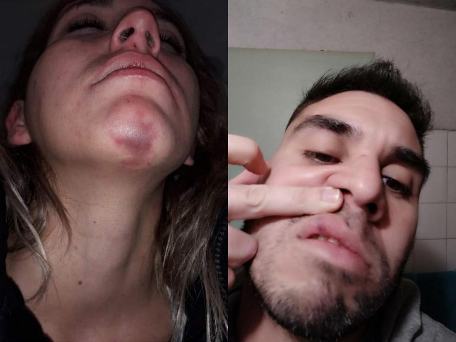 Un vecino de Ensenada acusado de golpear y torturar a su pareja se defendió en las redes sociales