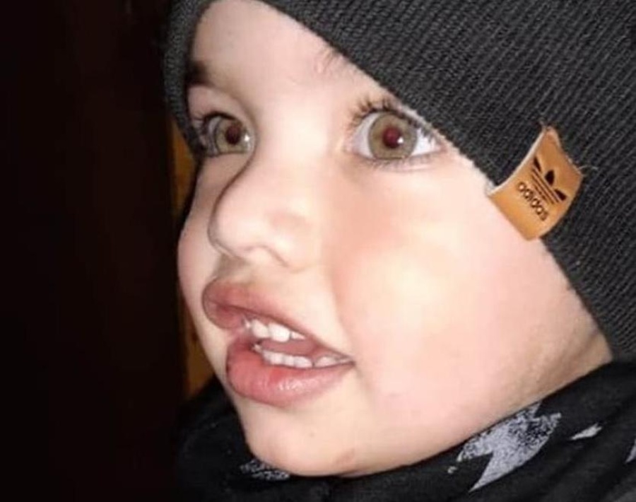 Un niño de 3 años de La Plata necesita una médula por un síndrome muy especial