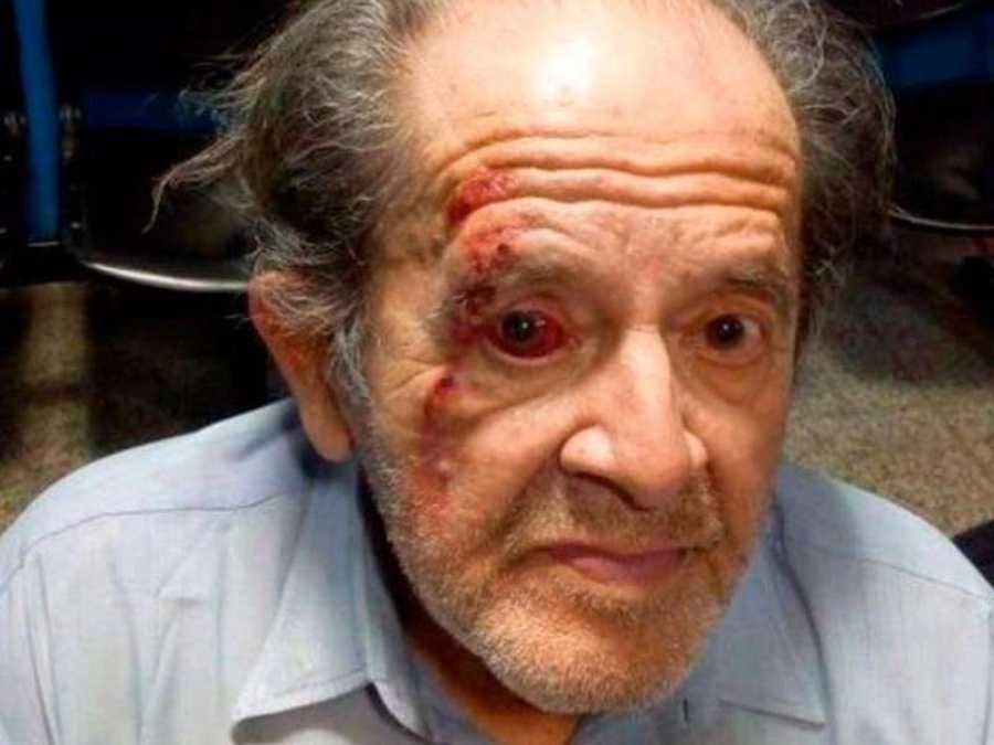 Un jubilado quedó en terapia intensiva tras ser golpeado por un guardia de un supermercado en Córdoba