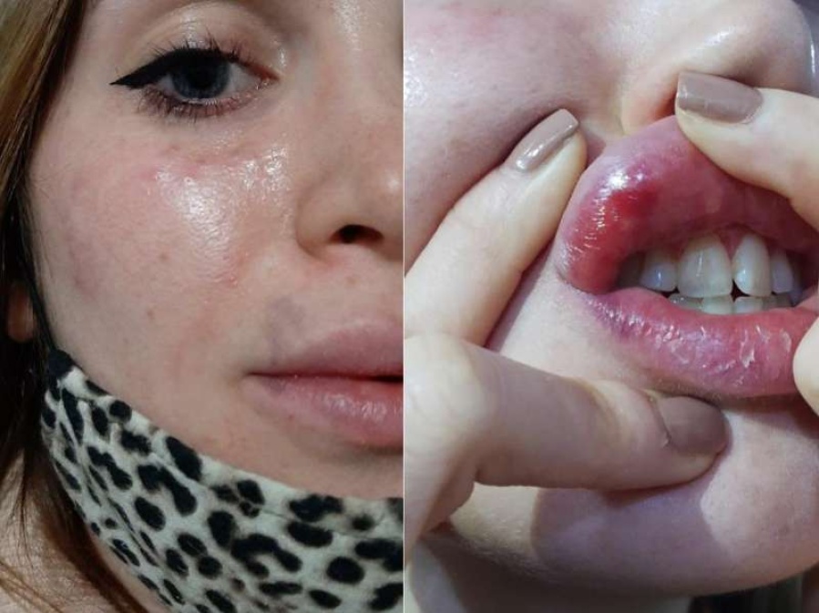 Sufrió violencia de género en La Plata, se liberó y lo contó: ”Me ahorcó, me pegó una piña en la cara y me dio la cabeza contra la pared”