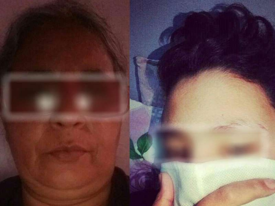 Una abuela platense cría sola a su nieto y necesitan donaciones desesperados: ”Hace dos días no comemos”