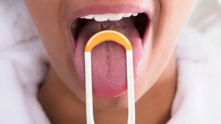 El color de la lengua puede advertir el estado de tu salud