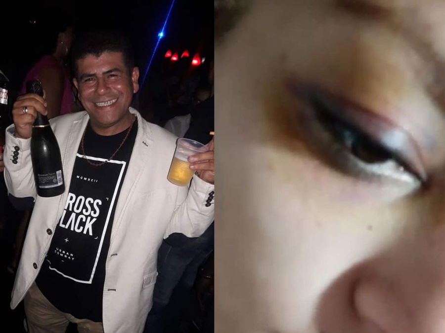 A fuerza de fierrazos, dejó inconsciente y al borde de la muerte a una mujer platense: “Pedía por su hija que no la mate”