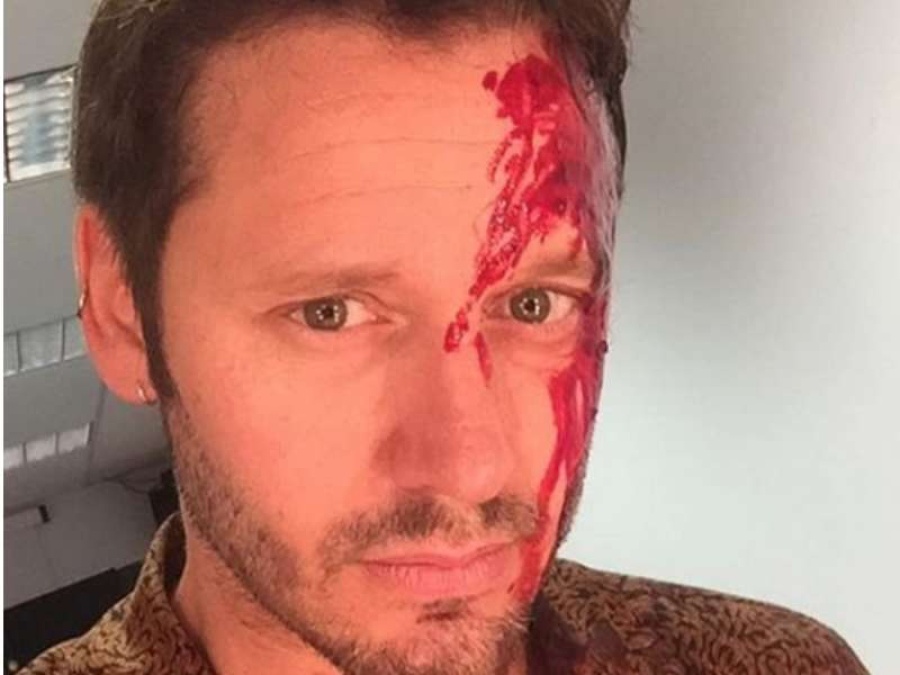 Así amaneció Benjamín Vicuña