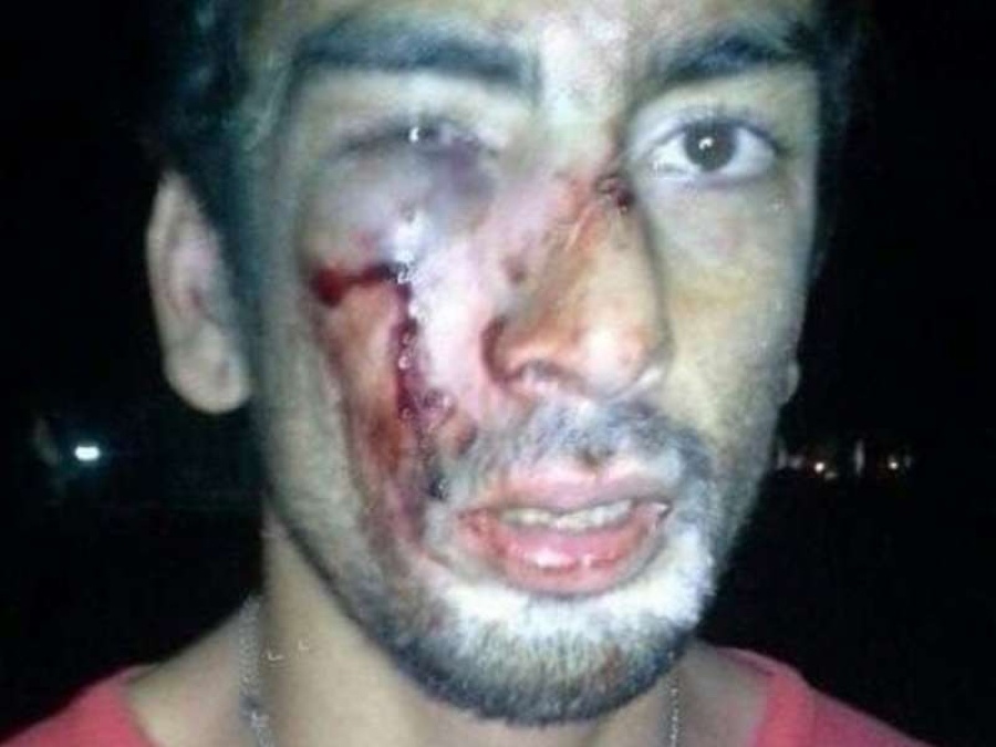 Un músico fue agredido por la seguridad de la República de los Niños en el Carnaval