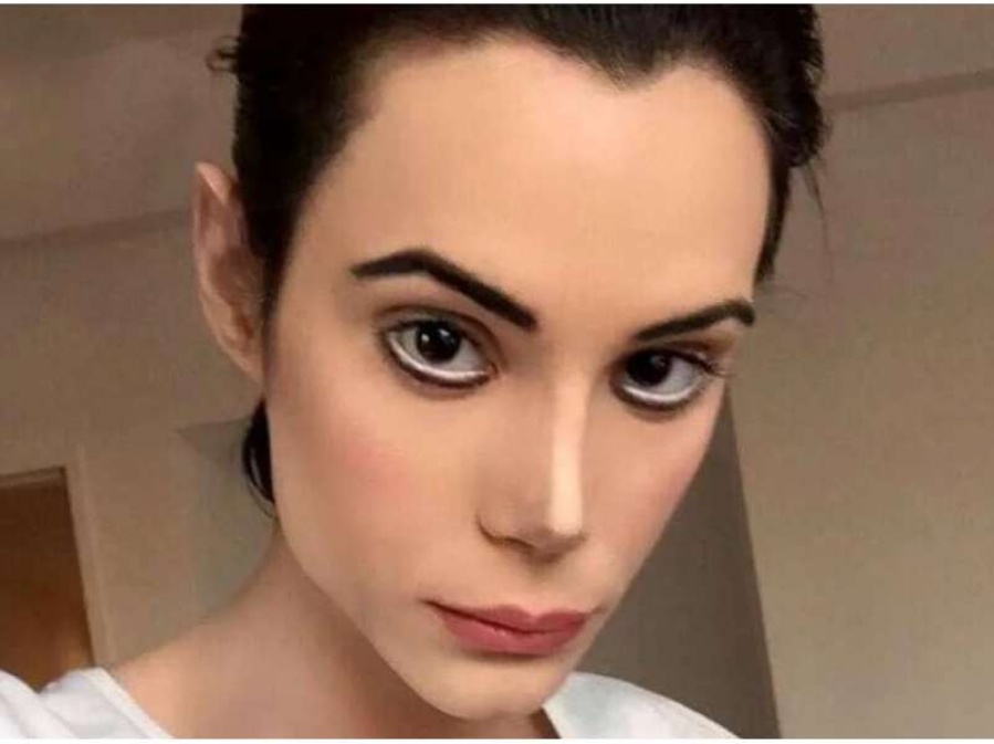 Felipe Pettinato se operó la nariz nuevamente