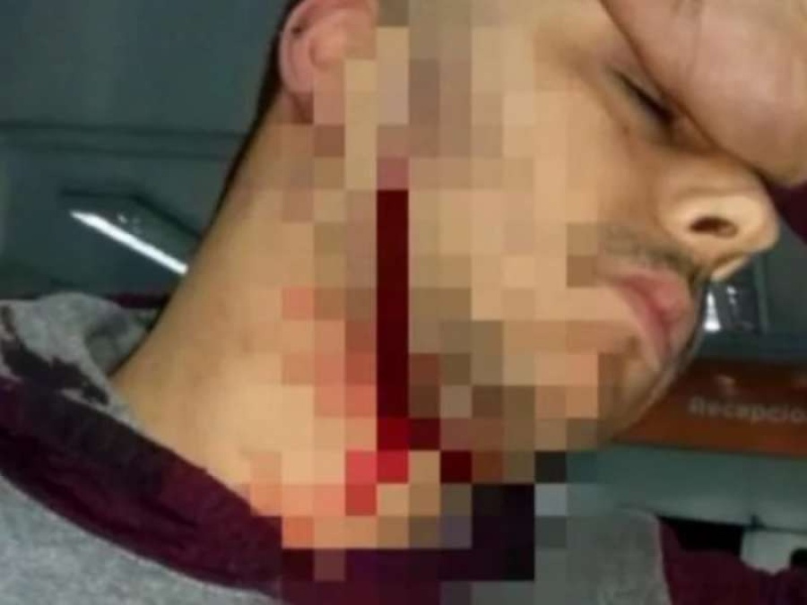 Le cortaron el cuello a un colectivero y le fracturaron la mano